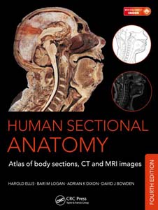 Human Sectional Anatomy: Atlas of Body Sections, CT and MRI Images